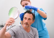Pregătirea pentru transplantul de păr: pași și sfaturi