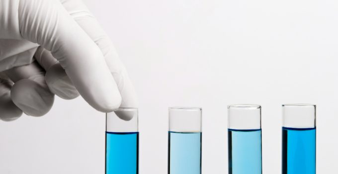 Analiza creatinină ce înseamnă? Ce indică rezultatele Analiza creatinină ce înseamnă? Ce indică rezultatele